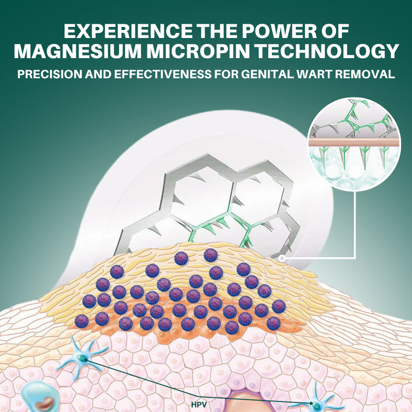 Juxek®  Wart Removal Pain-Free, Clinically Proven Solution