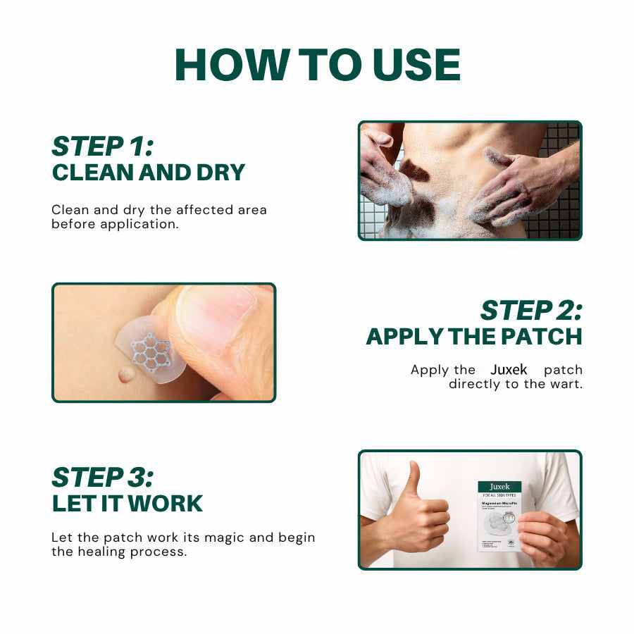 Juxek®  Wart Removal Pain-Free, Clinically Proven Solution